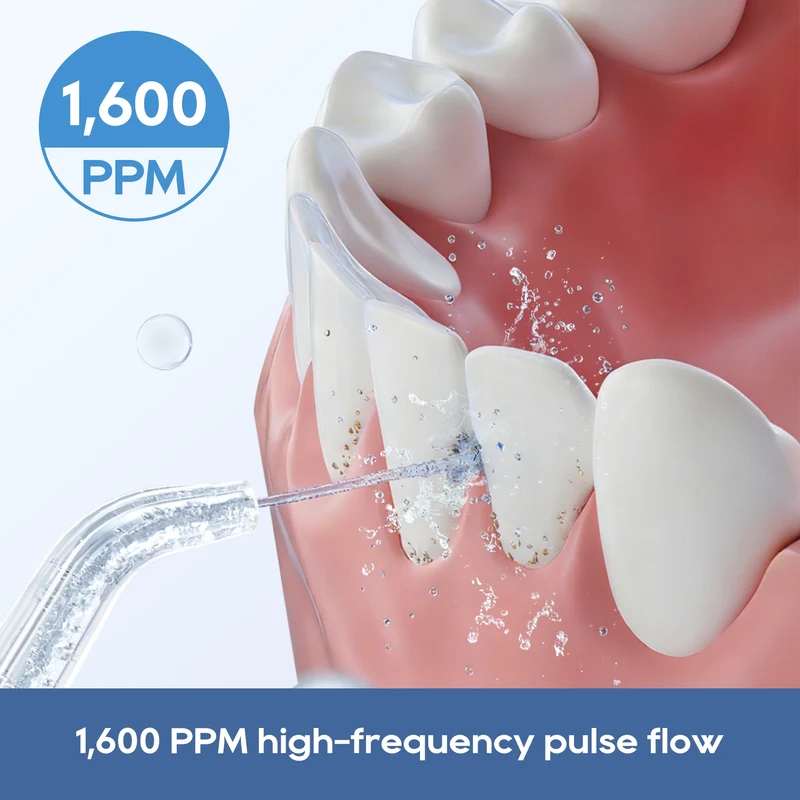 Dreame T02 Pro UV Portable Water Flosser